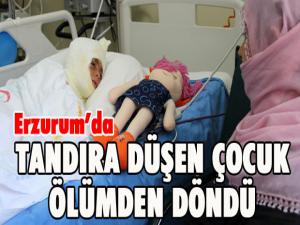 Tandıra düşen çocuk ölümden döndü 